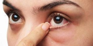 منها
      الأدوية
      والعمليات
      الجراحية،
      أسباب
      وأعراض
      جفاف
      العين