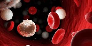 الضعف
      ونزيف
      الأنف،
      أهم
      أعراض
      وعلاجات
      سرطان
      الدم