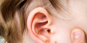قد
      تؤدي
      إلى
      فقدان
      السمع،
      أعراض
      وأسباب
      التهاب
      الأذن
      لدي
      الرضع
      والأطفال