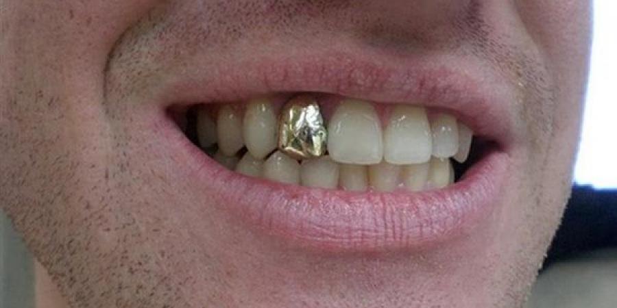 ما
      حكم
      حشو
      الأسنان
      بالذهب؟
      الإفتاء
      تجيب