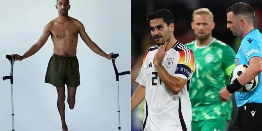 لاعب
      فقد
      ساقه
      وراء
      إيقاف
      مباراة
      ألمانيا
      والدنمارك
      "حكاية
      مُرعبة"