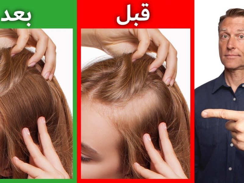 طريقة جاهزة لـ تكثيف الشعر وملئ الفراغات لإطالة الشعر ودعي التساقط نهائياً