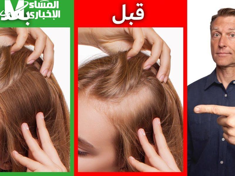 حلم تتمناه جميع الفتيات طريقة تكثيف الشعر بوصفات طبيعية وملئ الفراغات