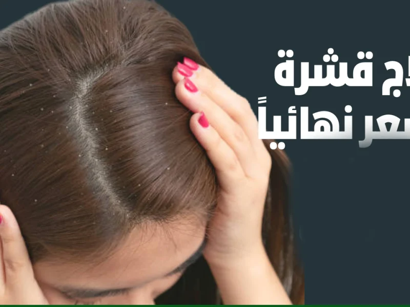 وصفة قشرت الإنترنت .. صوداء الخبز تعمل معجزة في علاج قشرة الشعر ولمعانه