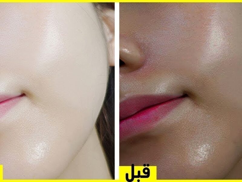 التفتيح جه فورًا .. وصفة طبيعية لتبييض البشرة وتفتيح 3 درجات من أول مرة