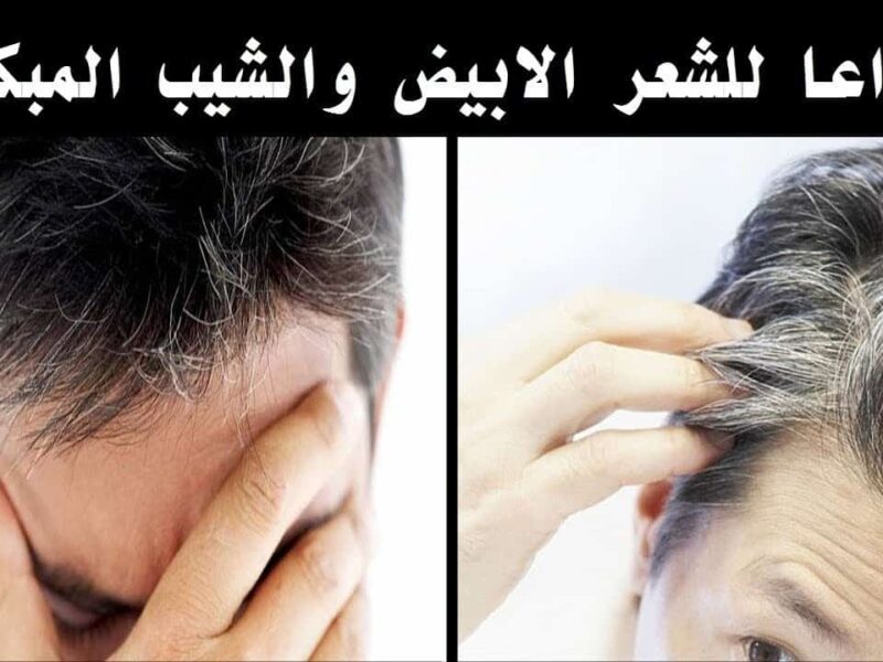 حل سهل للشيب المبكر .. طرق التخلص من الشيب المبكر هيرجع لون شعرك