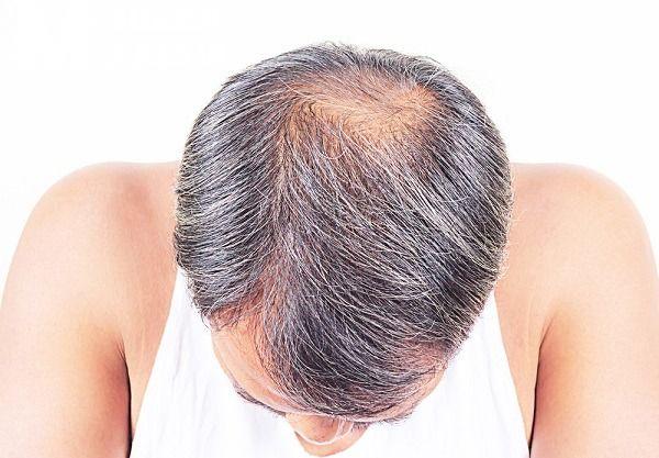 بهذه الطرق فقط.. ملئ الشعر وتكثيفه وزيادة الشعر في كافة الفراغات جربيها في البيت