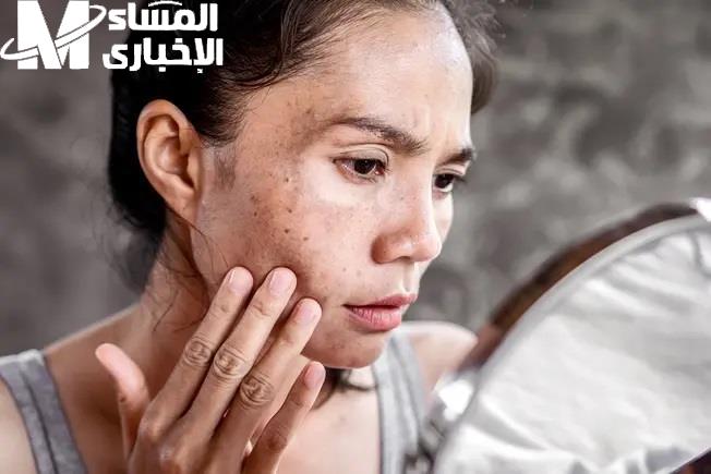 اكسير الحياة محلي الصنع.. طريقة عمل كولاجين طبيعي في البيت لشد البشرة وتنظيفها