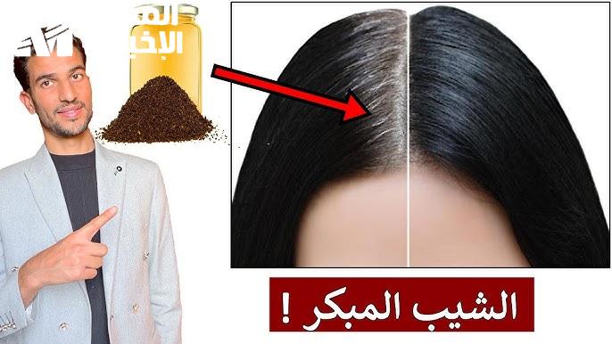 الشيب المبكر