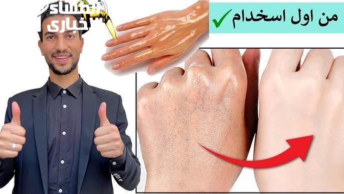 طريقة تقشير اليدين وإزالة البقع الداكنة