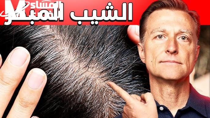 شبابك بيرجع يا نجم.. طرق التخلص من الشيب المبكر ترجعلك اللون والهيبة