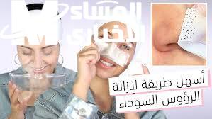 طرق ونصائح لإزالة الرؤوس السوداء