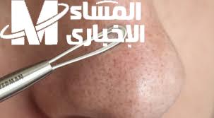 لبشرة نضرة وخالية من الشوائب… طرق ونصائح لإزالة الرؤوس السوداء