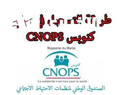 كنوبس