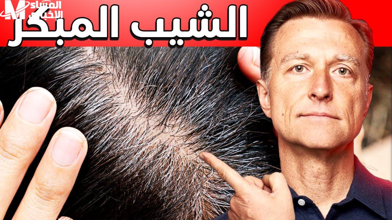الشيب المبكر