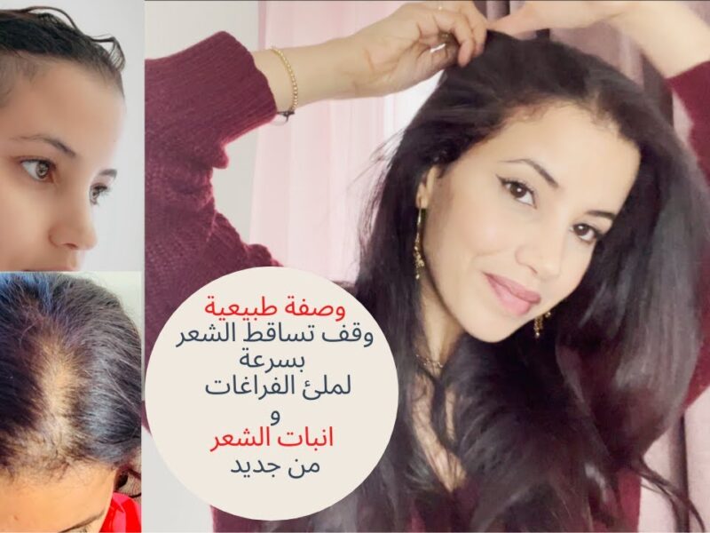الفراغ اتملأ بالشعر الناعم.. وصفة طبيعية توقف التساقط فورًا