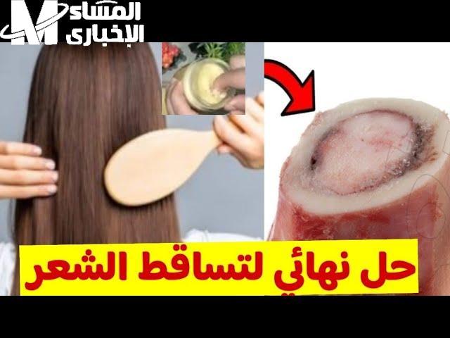 الشعر بيتنفّس فعلاً دلوقتي.. نخاع العظام لتكثيف ونمو الشعر بسرعة جنونية وبنتيجة مذهلة كثافة قوية
