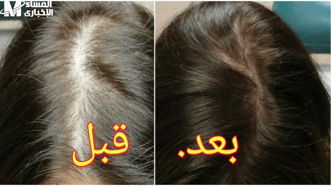ملء الشعر وتكثيفه