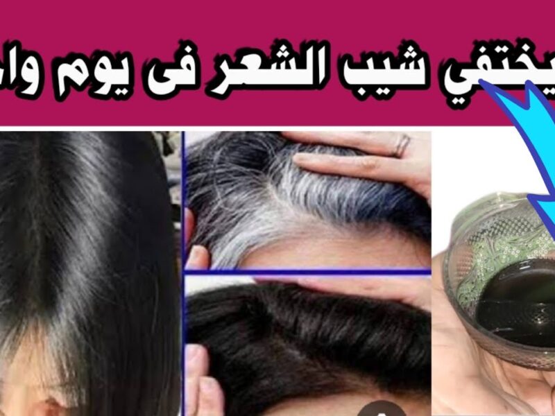 لون شعرك بيرجع طبيعي.. طرق التخلص من الشيب المبكر هيرجع لون شعرك حل مضمون