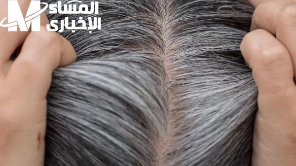 طرق التخلص من الشيب المبكر