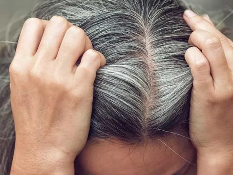 الشيب خرج من المعادلة تمامًا .. طرق التخلص من الشيب المبكر علاج نهائي