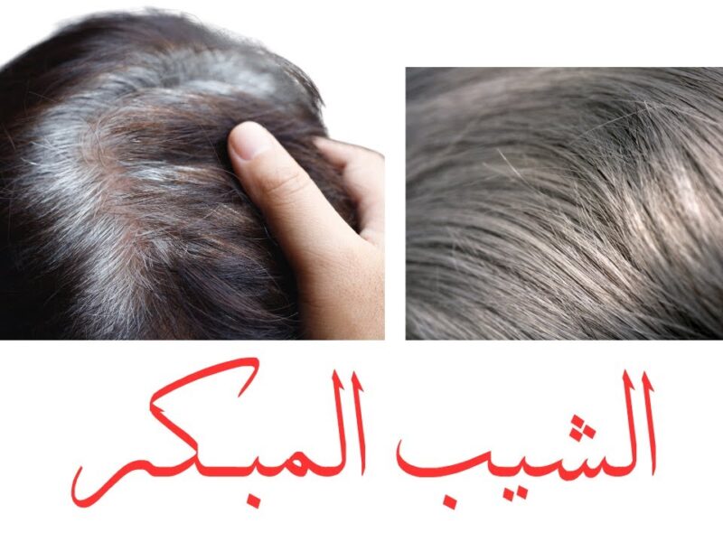 الشيب بيروح مع النظام .. طرق التخلص من الشيب المبكر هيرجع لون شعرك مظهر شبابي