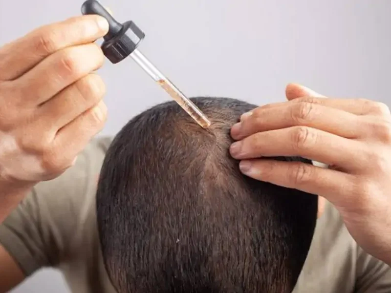 المرايا قالت خبر جميل .. علاج تساقط الشعر حل مضمون