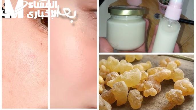 البشرة فاجأت المرايا فعلًا.. بشرة بتلمع من أول مرة كولاجين طبيعي للتفتيح والترطيب بمفعول سحري مضمون لمعة طبيعية