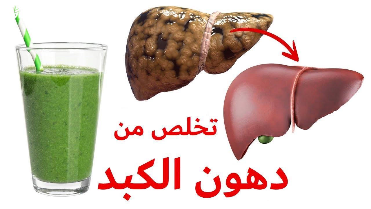 للتخلص من دهون الكبد