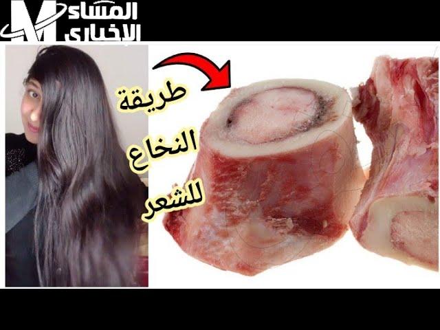 الخلايا صحت من النوم .. نخاع العظام للشعر يفجّر الكثافة
