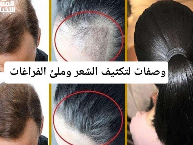 الفراغات هتختفي تمامًا.. تكثيف الشعر وملء الفراغات فعالية سريعة