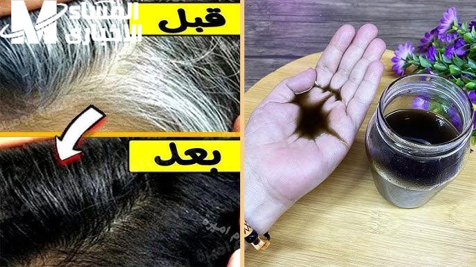 الشيب خد آخر فرصة.. وصفة تعالج الشيب المبكر وترجع اللون الطبيعي من غير صبغة