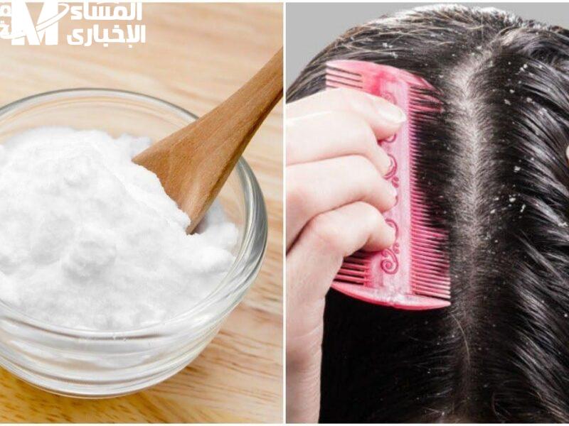 صوداء الخبز تعمل معجزة في علاج قشرة الشعر ولمعانه