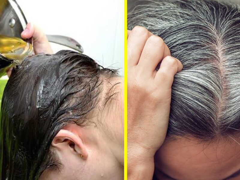 شباب وكأنهم شباب دائمًا.. طرق التخلص من الشيب المبكر هيرجع لون شعرك