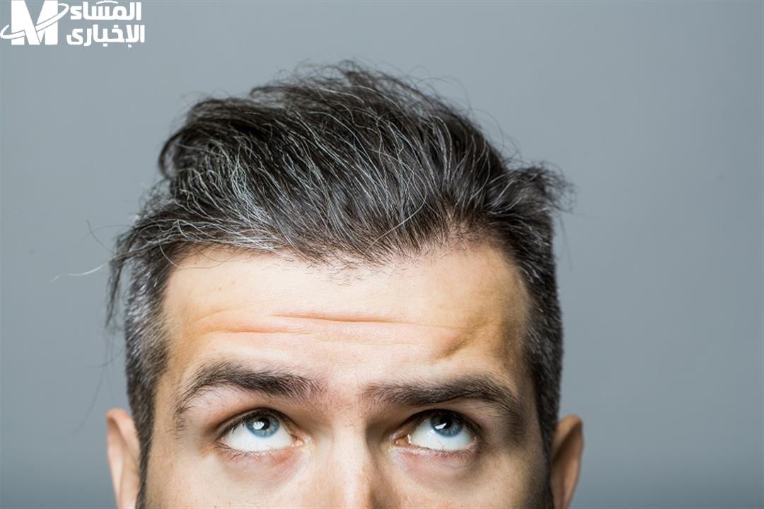 التخلص من الشيب المبكر
