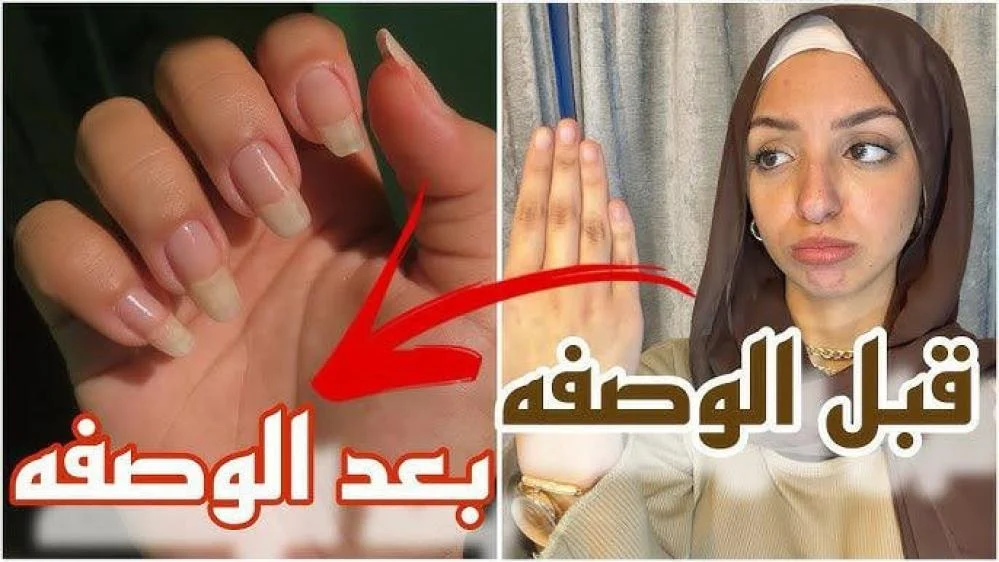 أظافرك