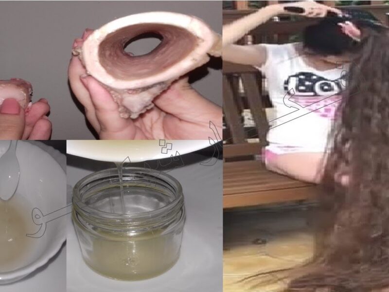 خلطة شعر خرافية.. نخاع العظام لتكثيف الشعر نتيجة مذهلة