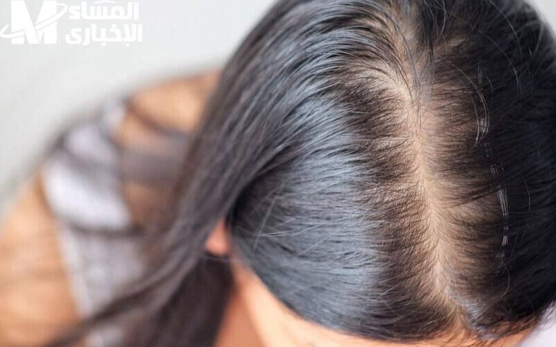 وقف تساقط الشعر هيرجع شعرك تاني وضوح وثقة