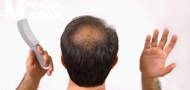 حل للتساقط في إيدك.. علاج بيوقف تساقط الشعر ويرجعه صحي تاني