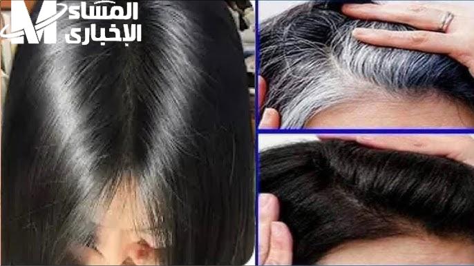 الشعر الأبيض