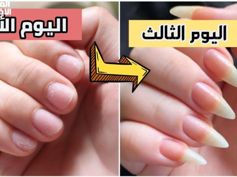 ظافرك هتكبر بسرعة كده.. طولي ظوافرك نتيجة سريعة
