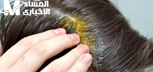 علاج تساقط الشعر