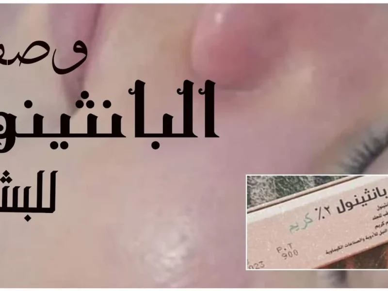 دلعي جوزك وابهريه .. طريقة سحرية لاستخدام كريم بانثينول